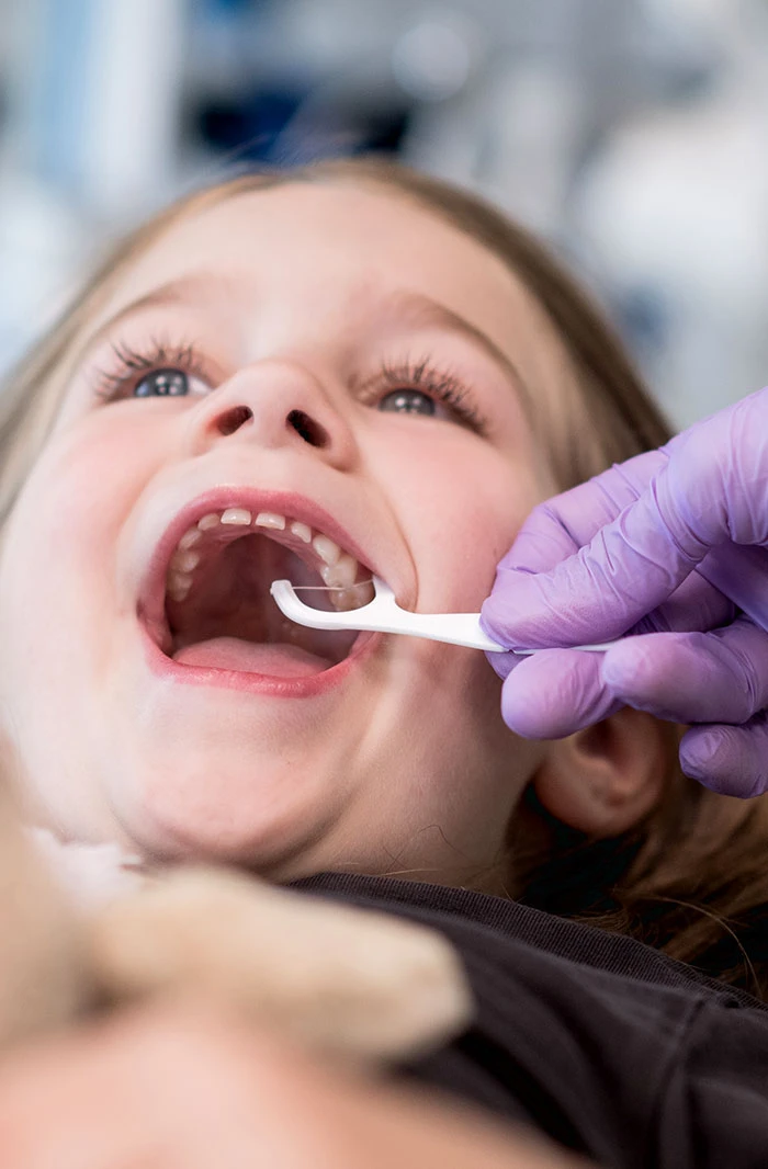 Kind an dem eine Professionelle Zahnreinigung durchgeführt wird
